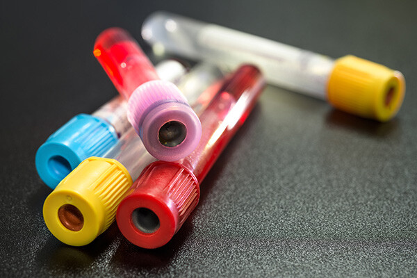 Image representing TEST RESULTS